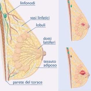 I dati sono allarmanti. La mancanza di uno stile di vita corretto, composto da buona alimentazione e limitazione degli eccessi, sta portando ad un incremento dei tumori per le giovani donne
